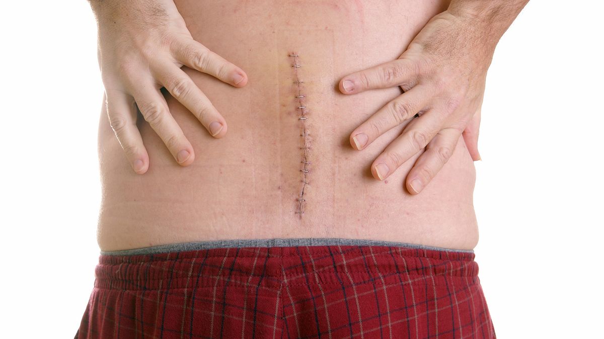 Spinal Cancer-Symptoms-Diagnosis-Homeopathic-Allopathic-Treatment-Dr-Qaisar-Ahmed-Al Haytham-Clinic
